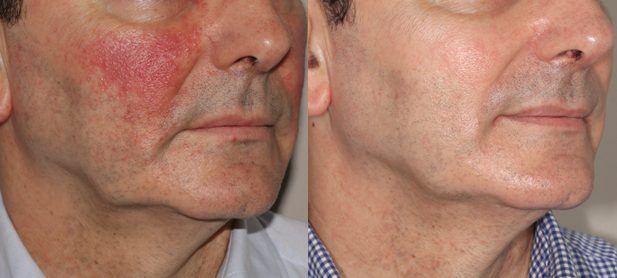 Calm healthy skin